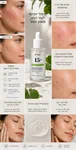 סרום מרגיע ועוצמתי Anua Azelaic Acid 15 2
