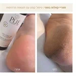 ספריי קאלוס בוטני 125 מ"ל – PLIE 2